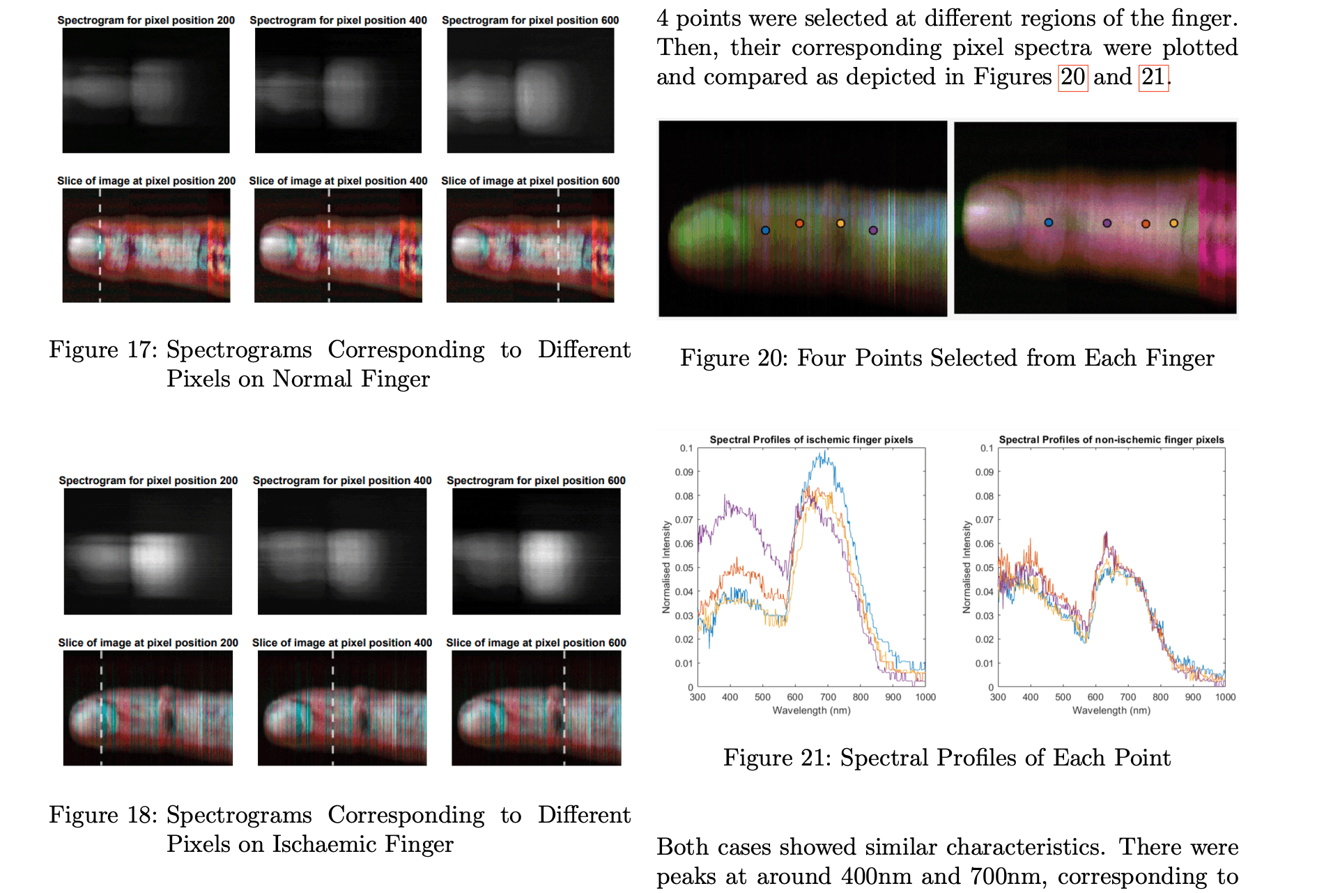 Hyperspectral Brain Imaging